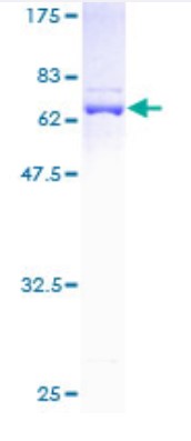 SDS-PAGE (DNAJB1-2730H).jpg